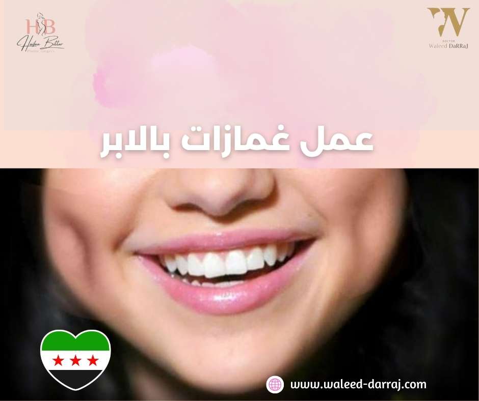 عمل غمازات بالابر