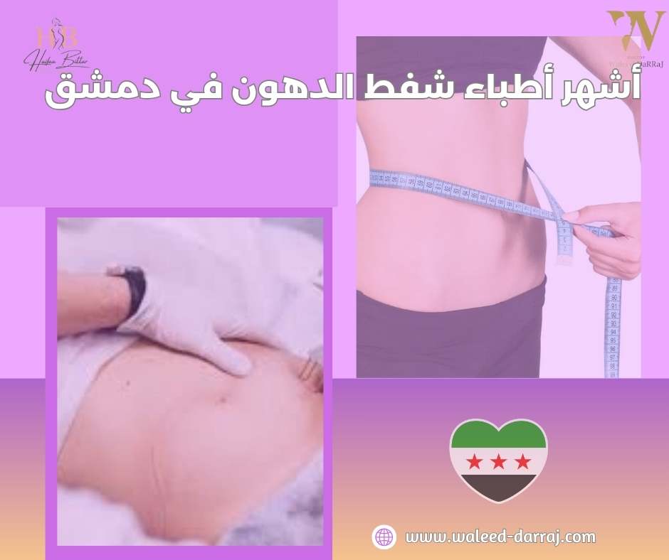 كيف تختار طبيب شفط الدهون في دمشق؟