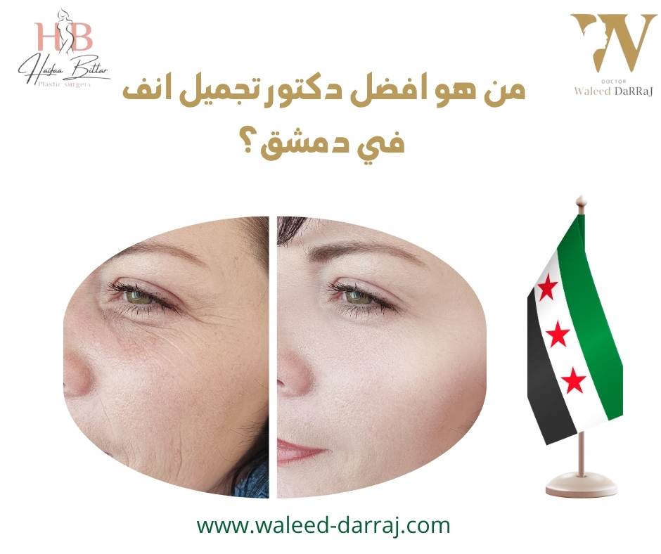 من هو افضل دكتور تجميل انف في دمشق