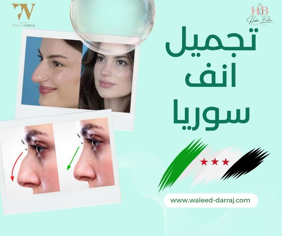 تجميل انف سوريا