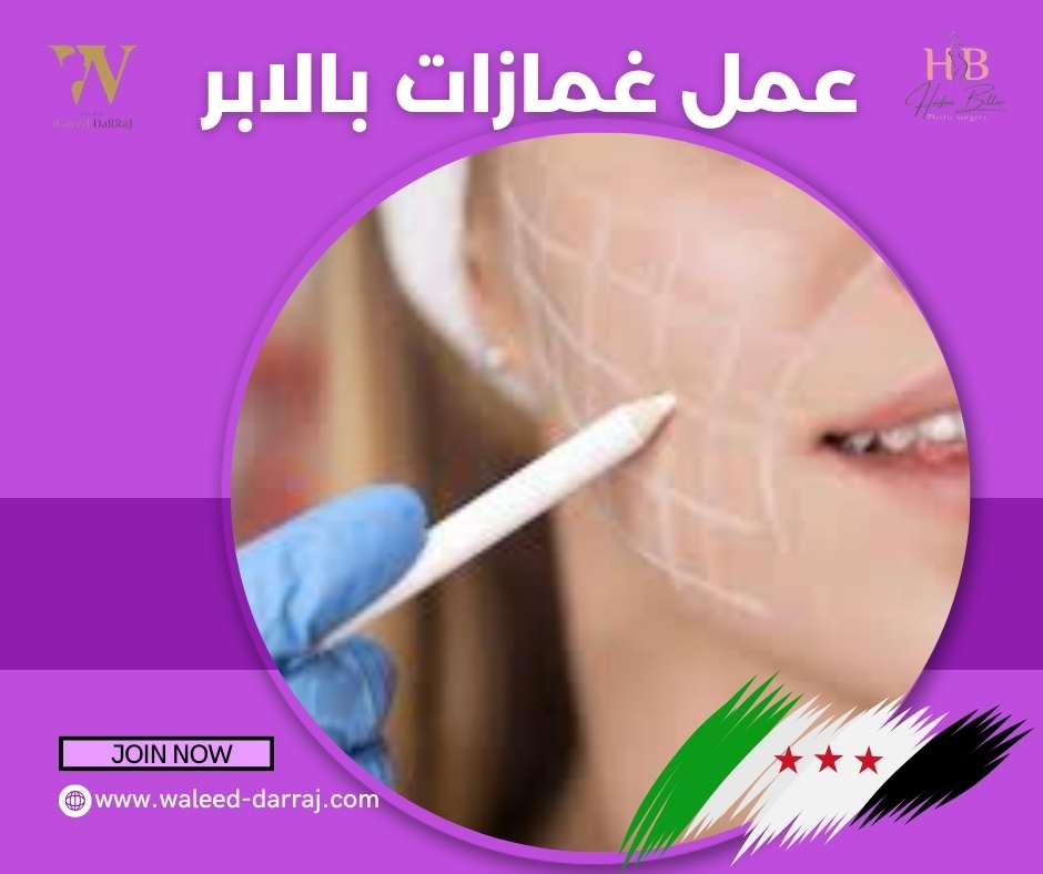 عمل غمازات بالابر