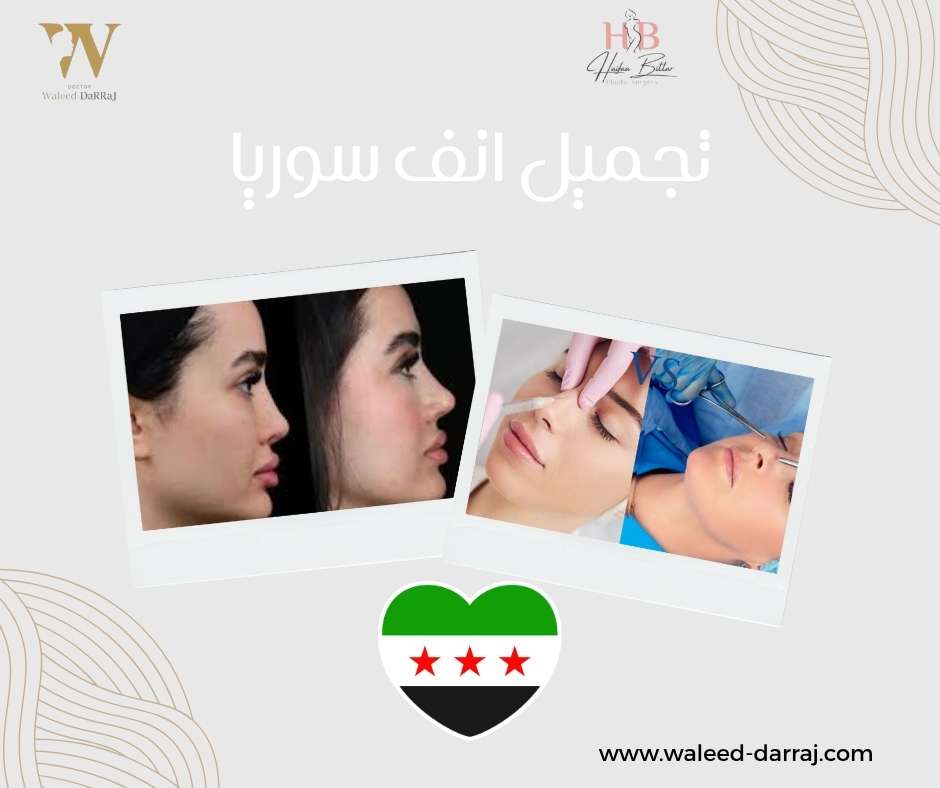 تجميل انف سوريا