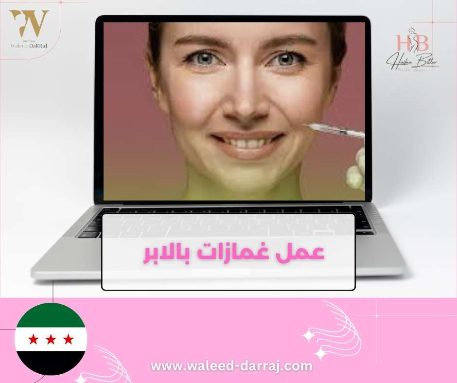 عمل غمازات بالابر