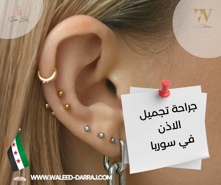 جراحة تجميل الاذن في سوريا
