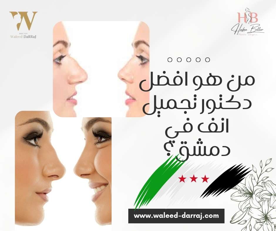 من هو افضل دكتور تجميل انف في دمشق