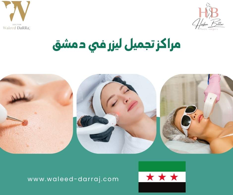 مراكز تجميل ليزر في دمشق