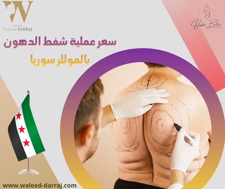 سعر عملية شفط الدهون بالموللر سوريا