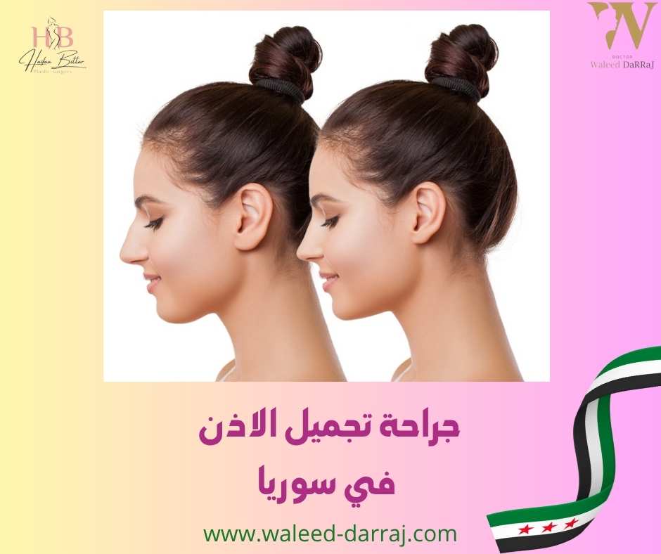 جراحة تجميل الاذن في سوريا