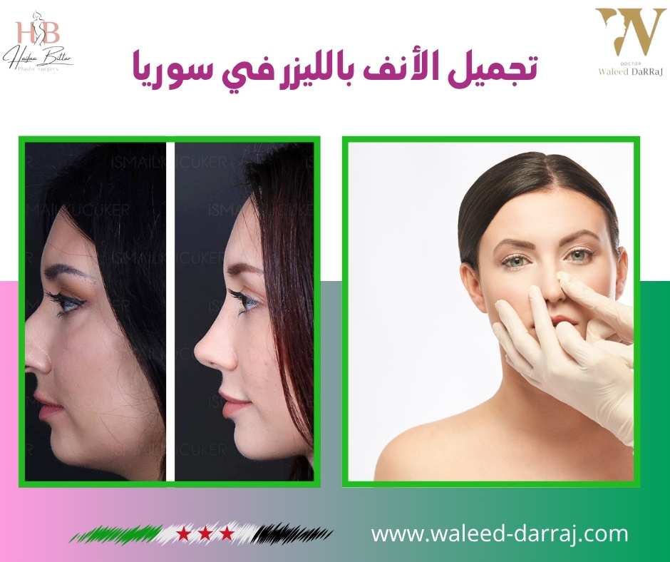 تجميل الأنف بالليزر في سوريا