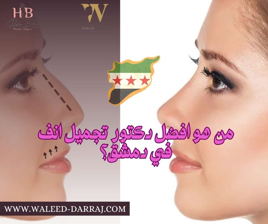 من هو افضل دكتور تجميل انف في دمشق