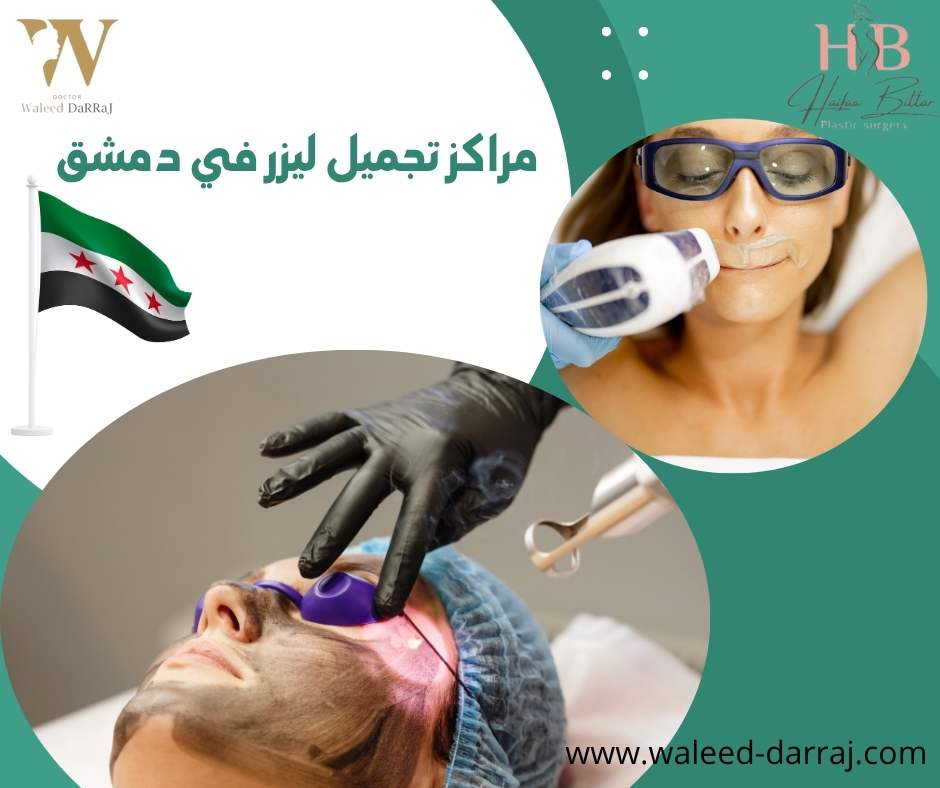 مراكز تجميل ليزر في دمشق