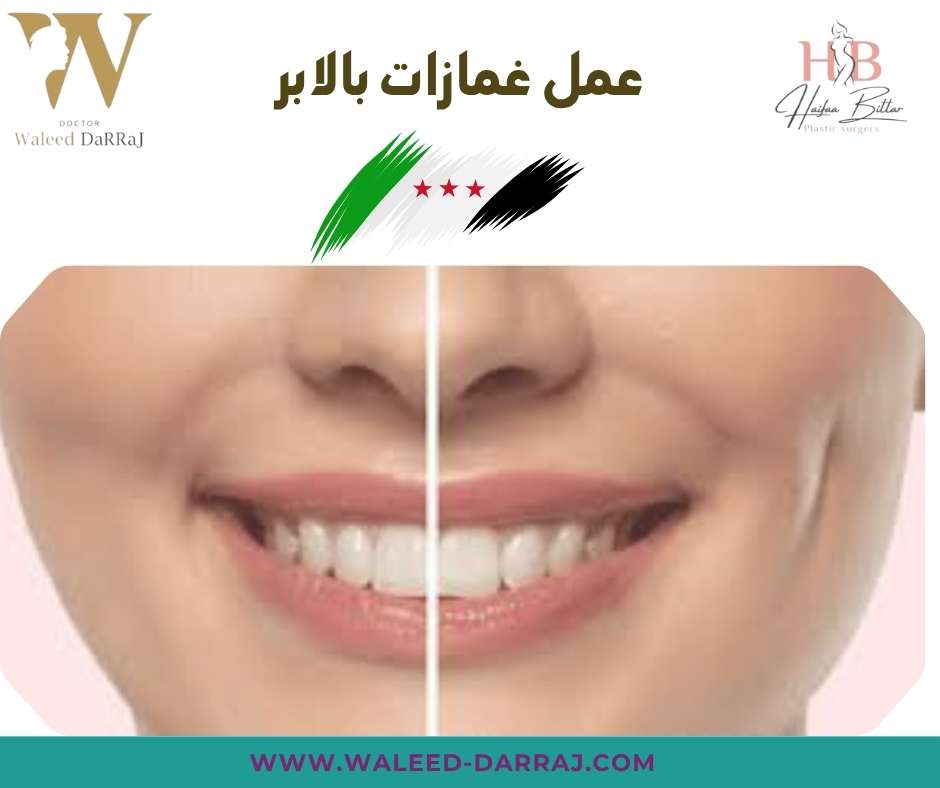 عمل غمازات بالابر