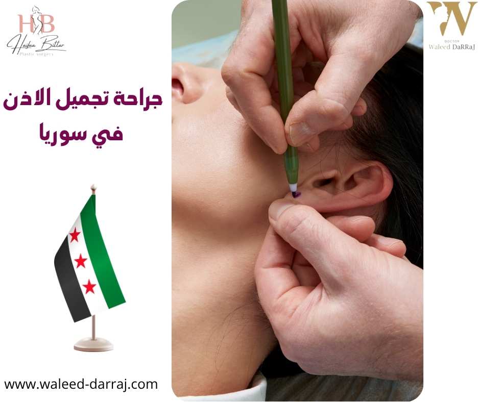 جراحة تجميل الاذن في سوريا
