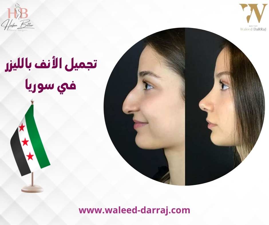 تجميل الأنف بالليزر في سوريا