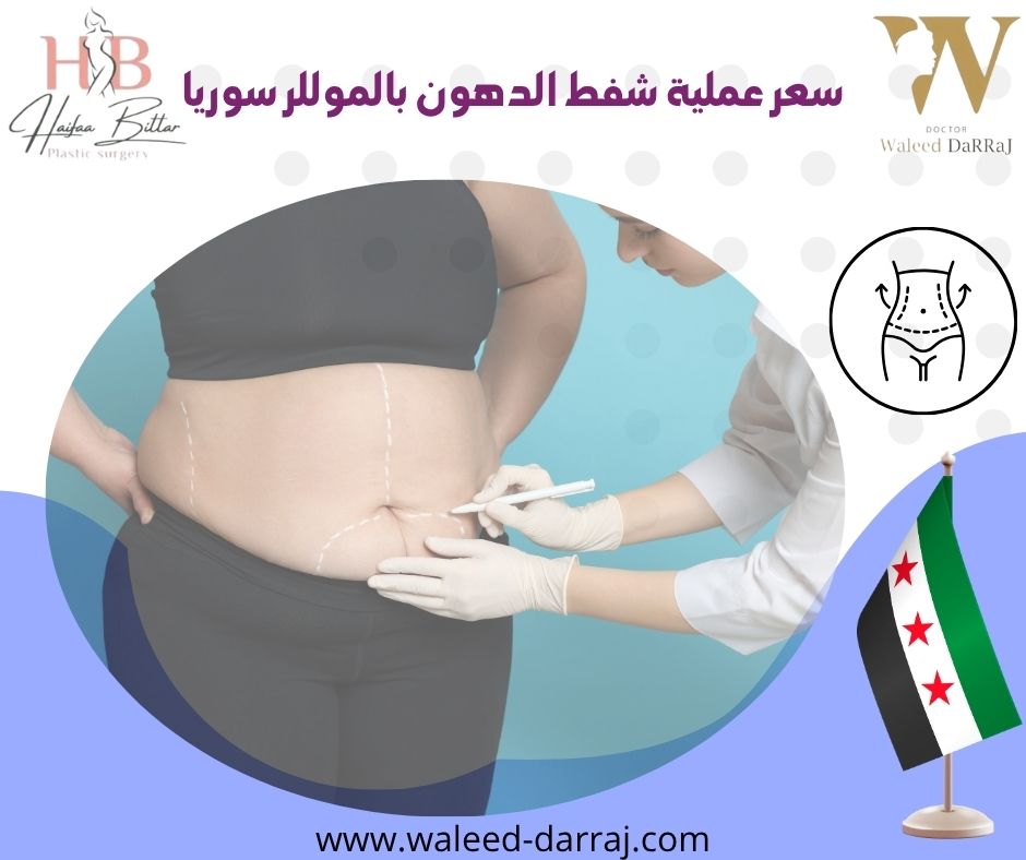 سعر عملية شفط الدهون بالموللر سوريا