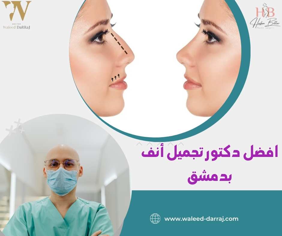 افضل دكتور تجميل أنف بدمشق