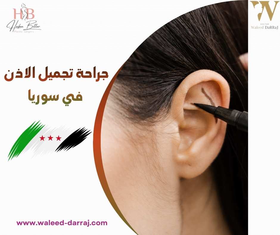 جراحة تجميل الاذن في سوريا