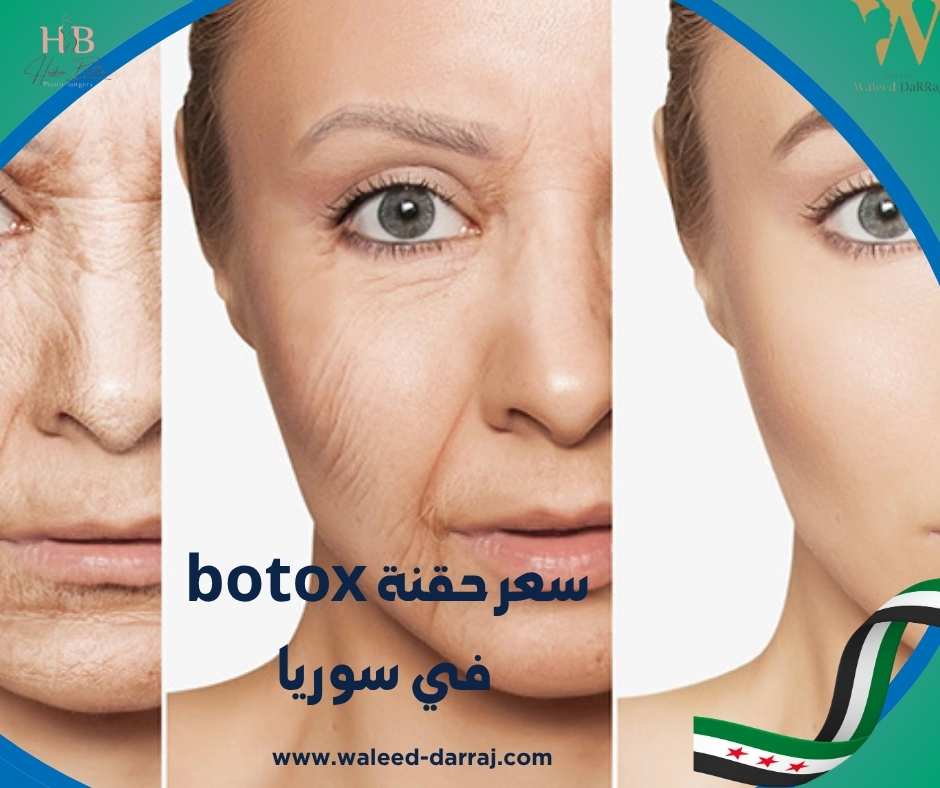 سعر حقنة botox في سوريا