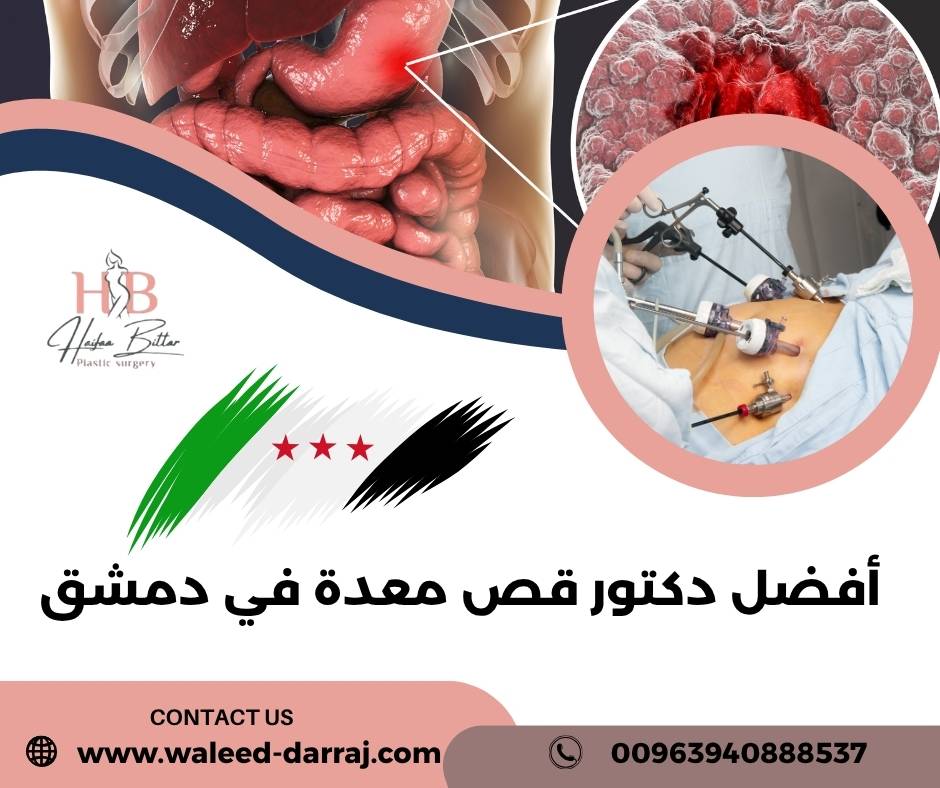 أفضل دكتور قص معدة في دمشق