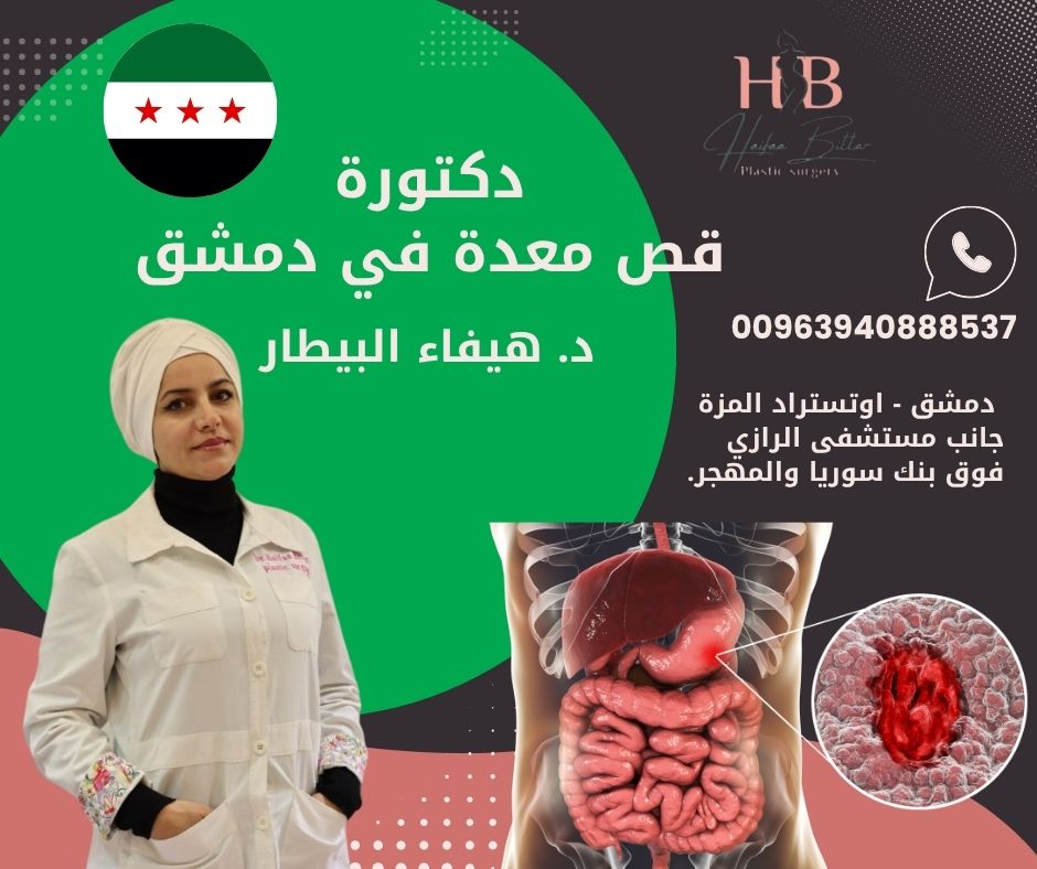 دكتورة قص وتكميم معدة في دمشق 