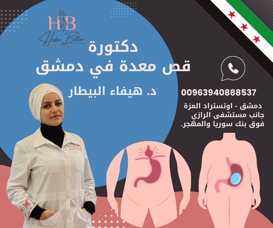 دكتور قص معدة في سوريا 