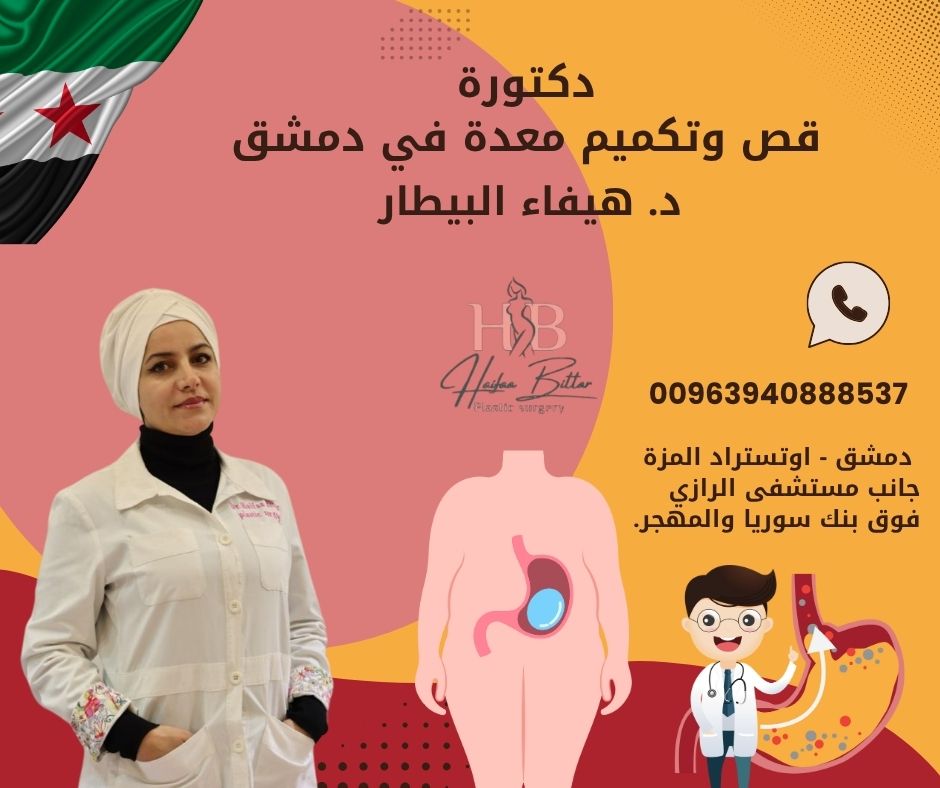 دكتور قص معدة في دمشق
