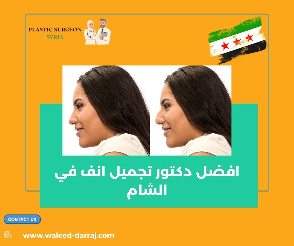 افضل دكتور تجميل انف في الشام