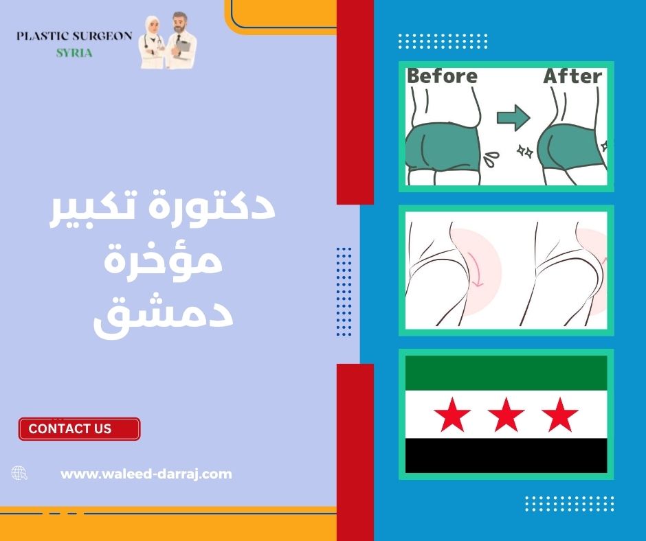 دكتورة تكبير مؤخرة دمشق
