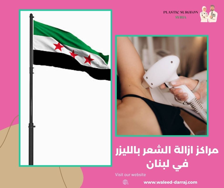 مراكز ازالة الشعر بالليزر في لبنان