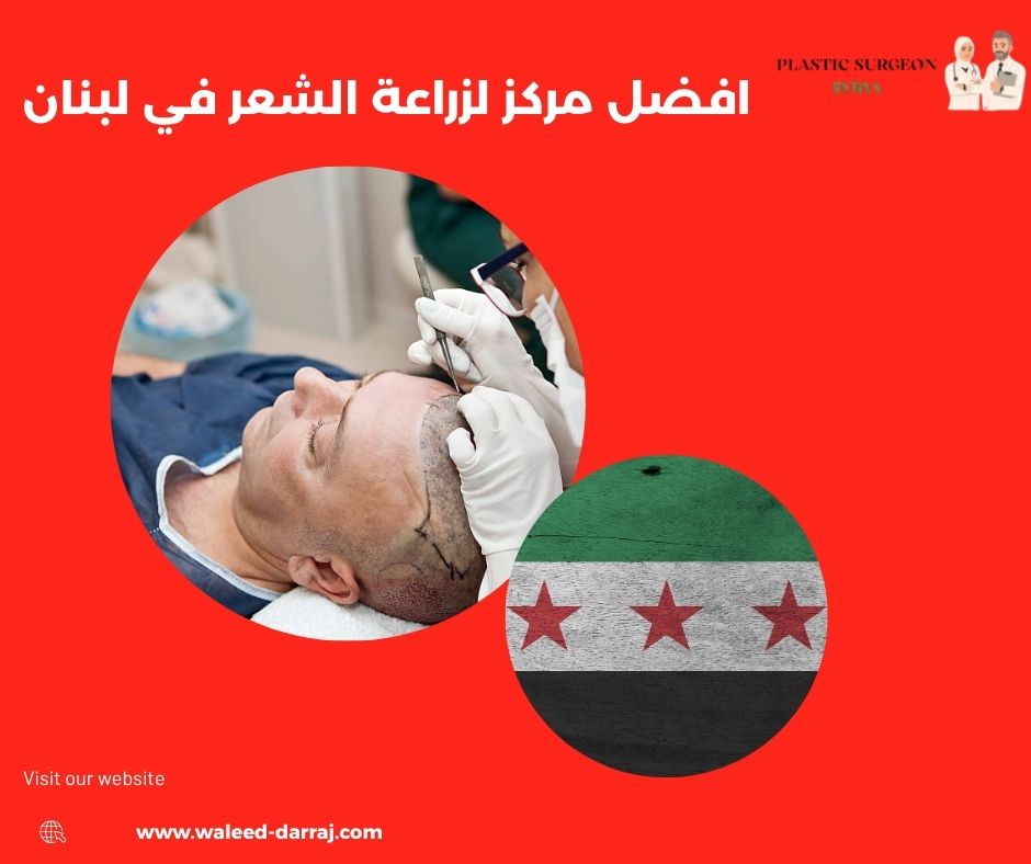 افضل مركز لزراعة الشعر في لبنان