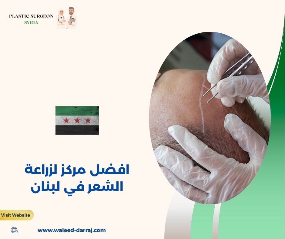 افضل مركز لزراعة الشعر في لبنان