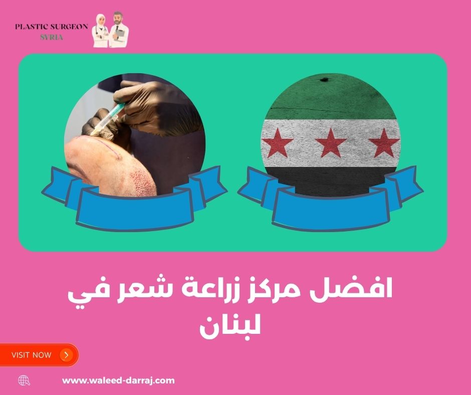 افضل مركز زراعة شعر في لبنان