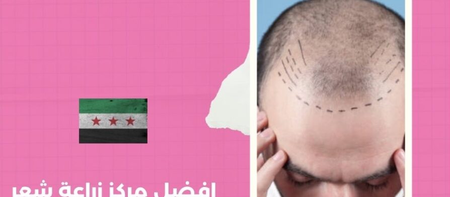 افضل مركز زراعة شعر في لبنان