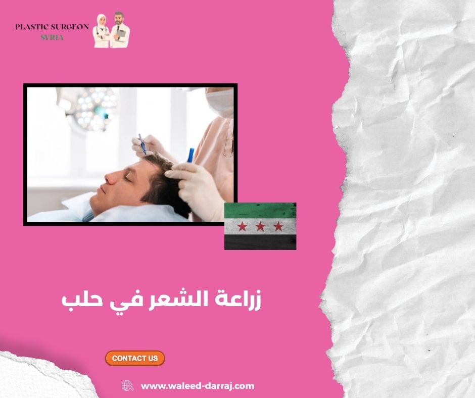 زراعة الشعر في حلب