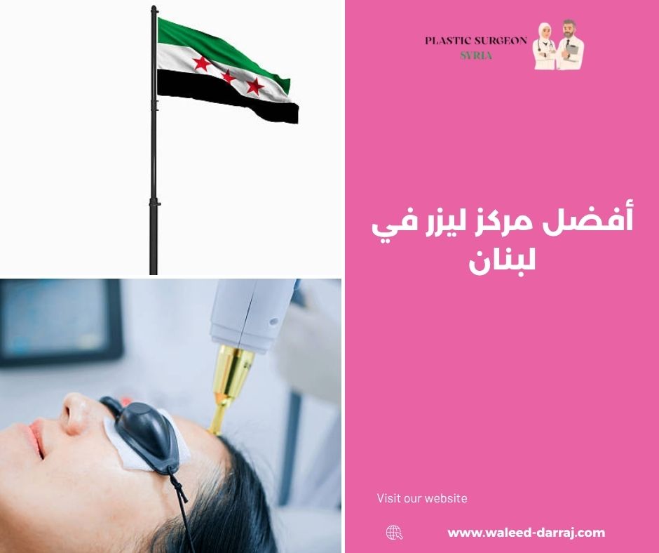 أفضل مركز ليزر في لبنان