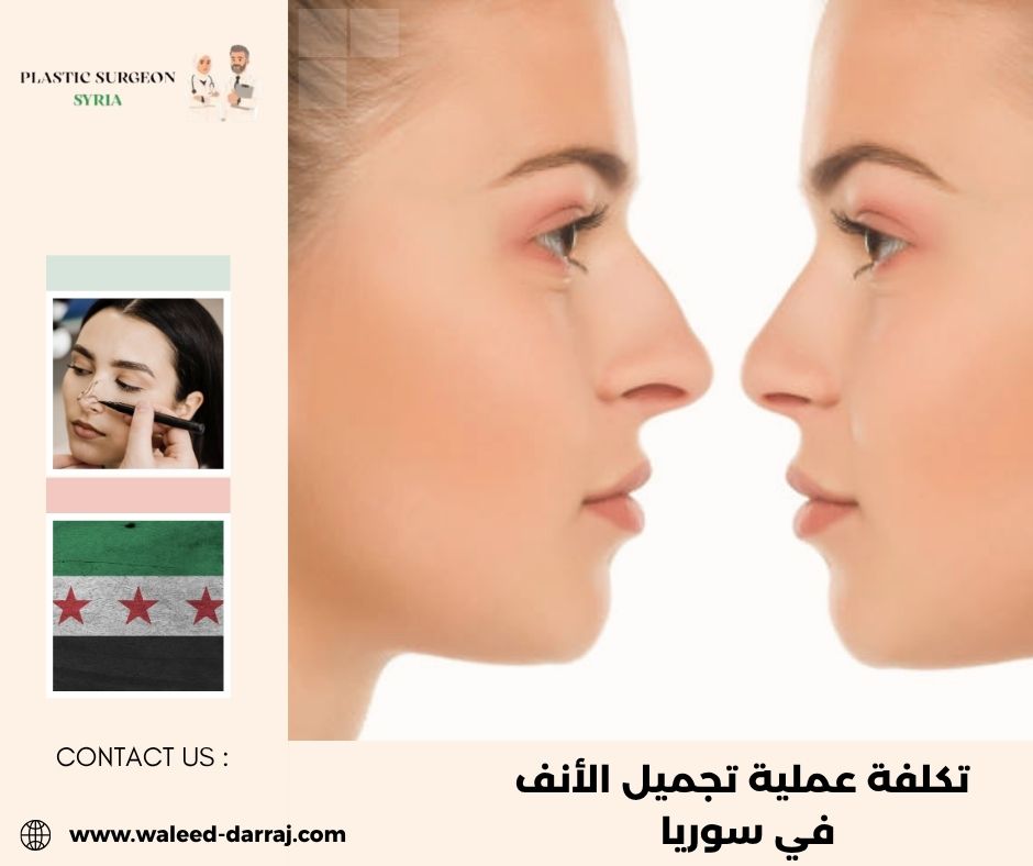 تكلفة عملية تجميل الأنف في سوريا 2026