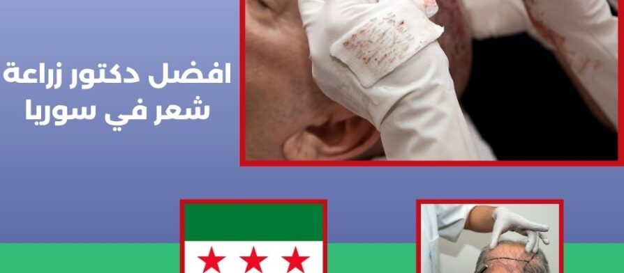 افضل دكتور زراعة شعر في سوريا