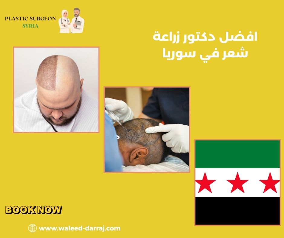 افضل دكتور زراعة شعر في سوريا