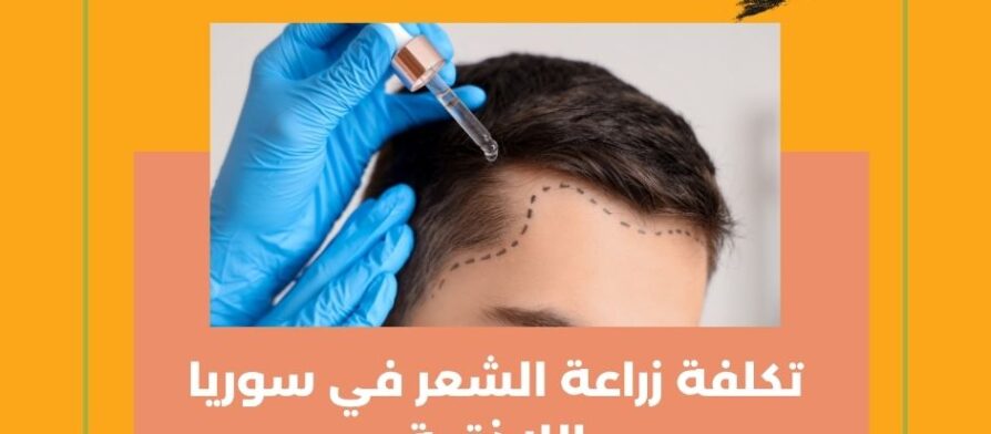 تكلفة زراعة الشعر في سوريا اللاذقية