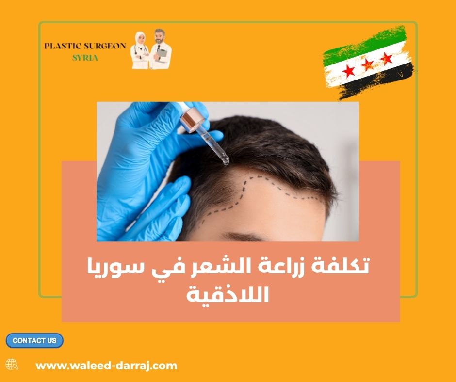 تكلفة زراعة الشعر في سوريا اللاذقية