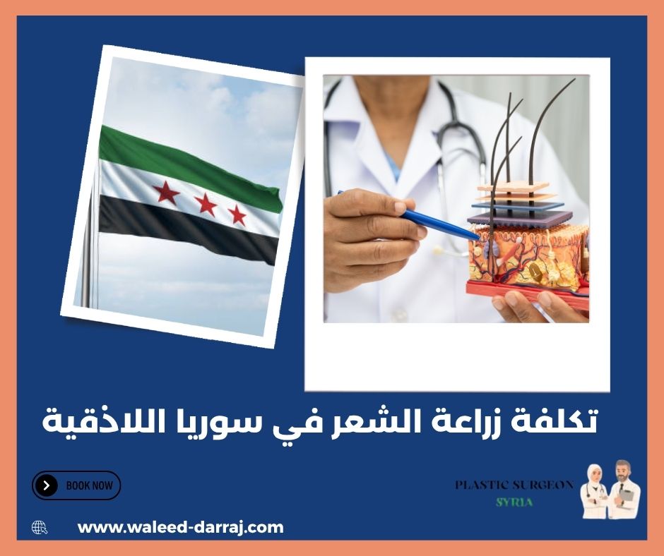 تكلفة زراعة الشعر في سوريا اللاذقية تكلفة زراعة الشعر في سوريا اللاذقية