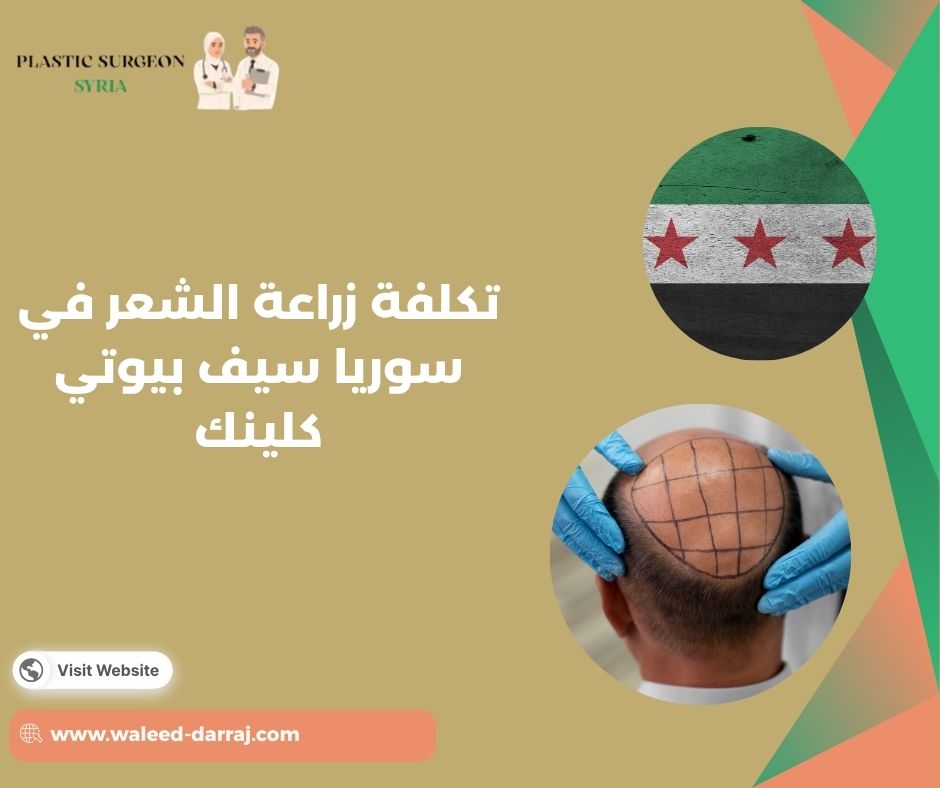 تكلفة زراعة الشعر في سوريا سيف بيوتي كلينك