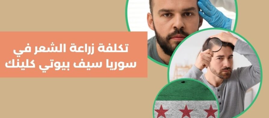 تكلفة زراعة الشعر في سوريا سيف بيوتي كلينك