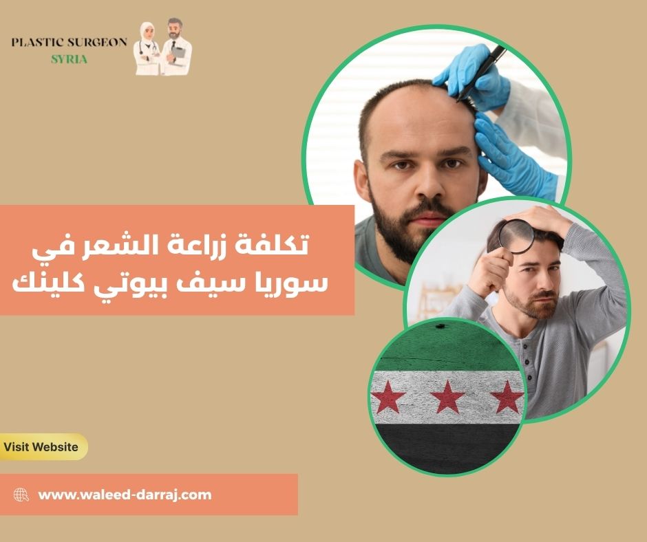 تكلفة زراعة الشعر في سوريا سيف بيوتي كلينك