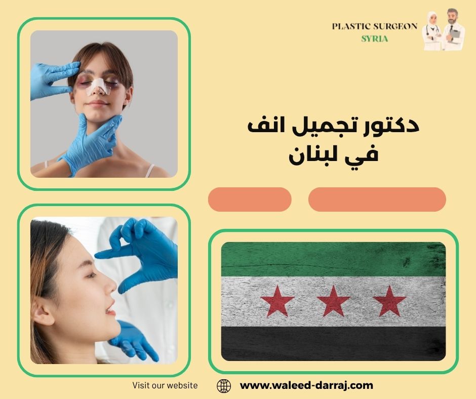 دكتور تجميل انف في لبنان