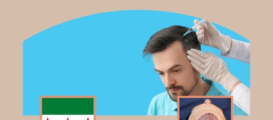 ما هو أفضل عمر لزراعة الشعر؟