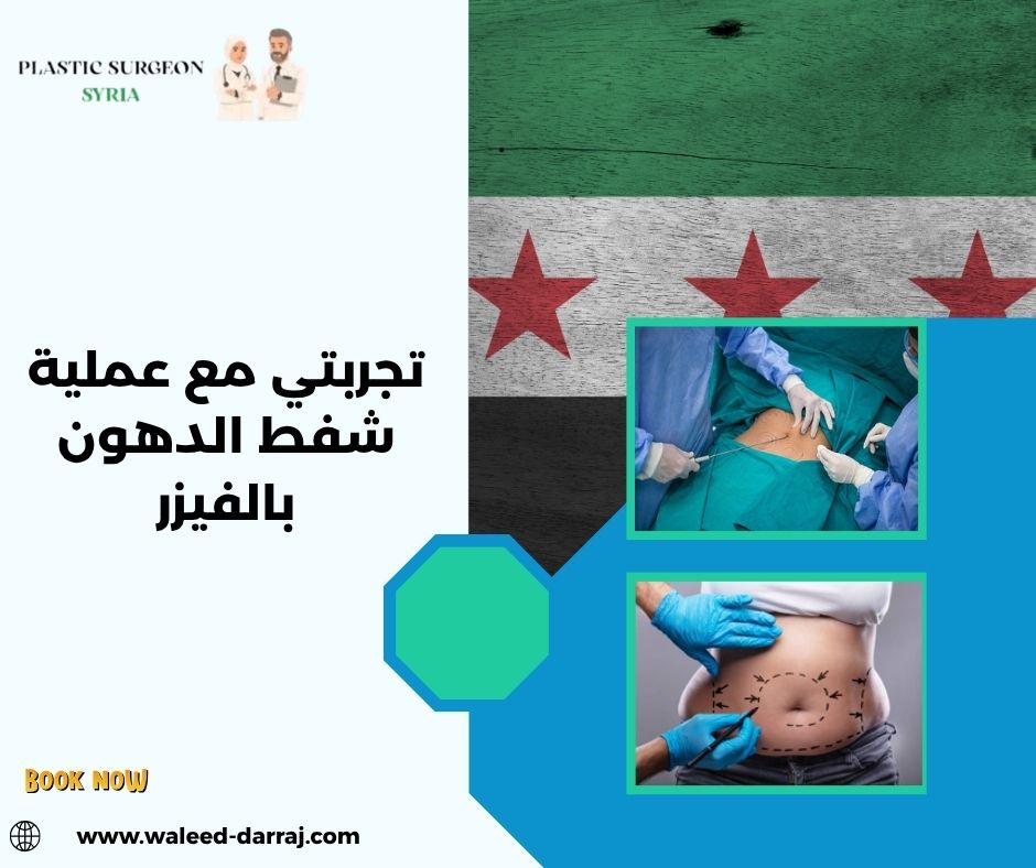 تجربتي مع عملية شفط الدهون بالفيزر