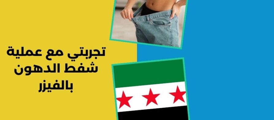 تجربتي مع عملية شفط الدهون بالفيزر