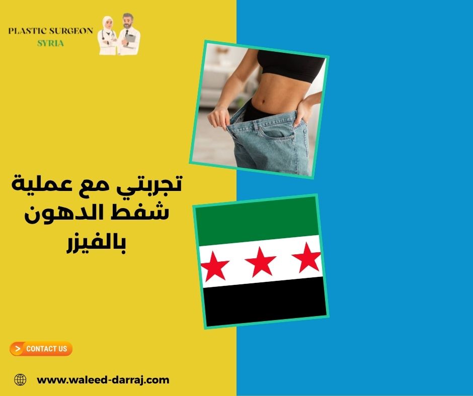 تجربتي مع عملية شفط الدهون بالفيزر