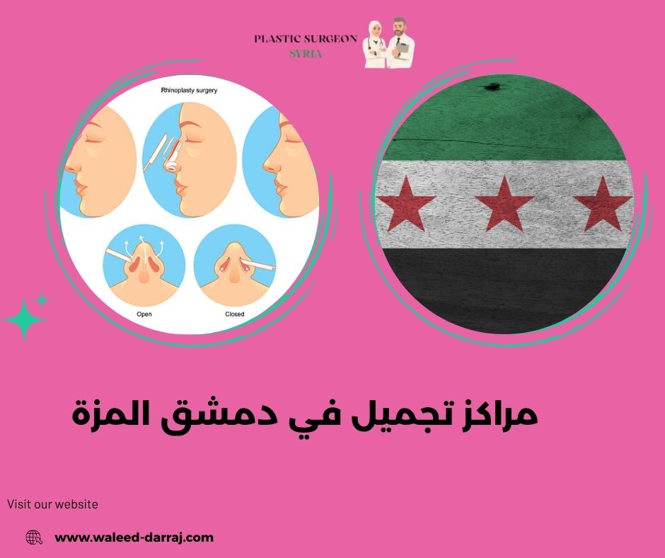 مراكز تجميل في دمشق المزة